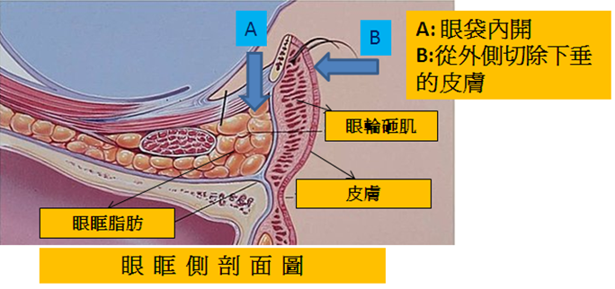 眼眶測剖面圖